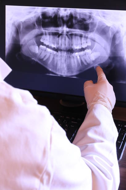 Best Emergency Wisdom Teeth Removal in Buena Park, CA